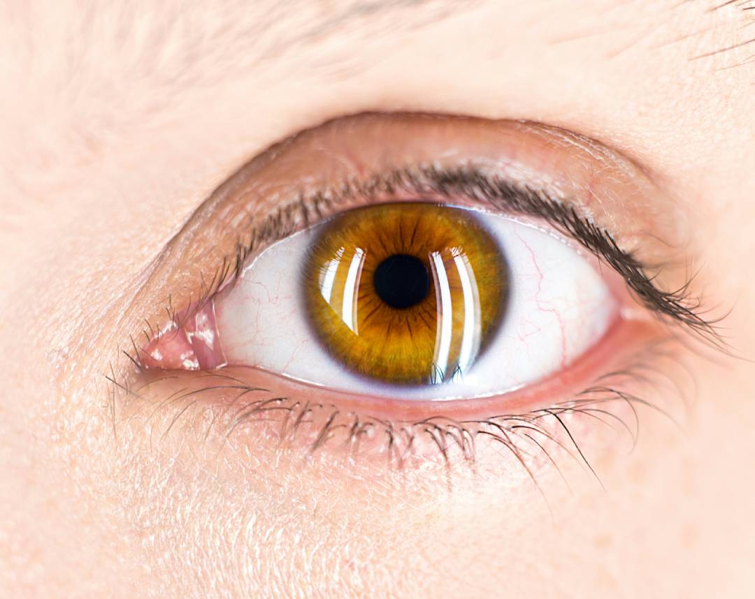 ojo